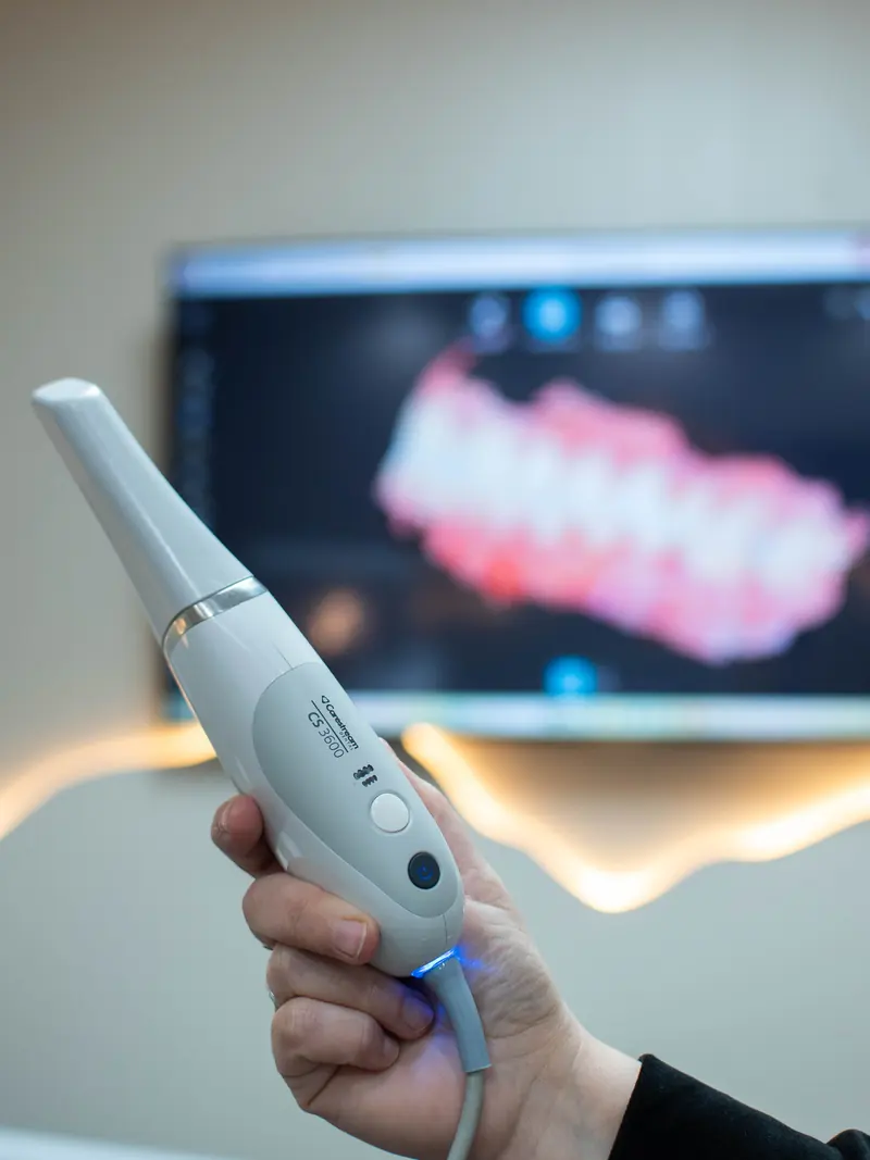 Escáner intraoral y modelo digital de la arcada en pantalla